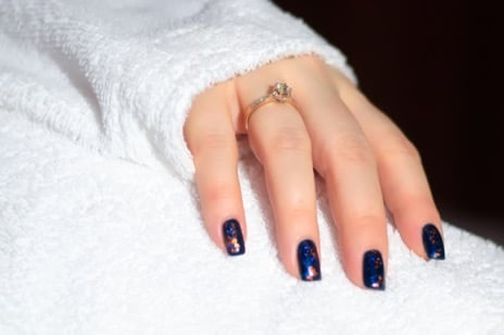 Nagels